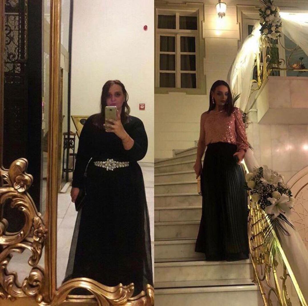 T&uuml;p mide ameliyatı ile 72 kilo veren Ceren Saltoğlu yepyeni biri oldu!