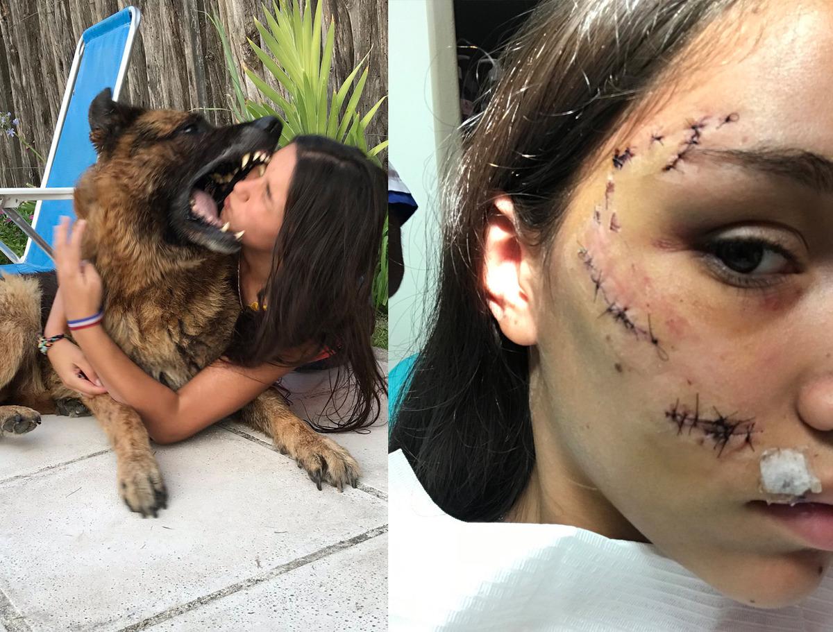 O andan sonrası korkun&ccedil;! 40 dikiş atıldı