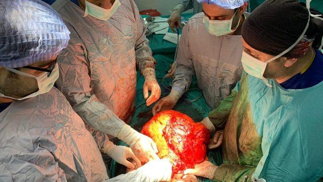 Şişlik nedeniyle gittiği hastanede karnında 11 kiloluk kitle olduğunu öğrendi