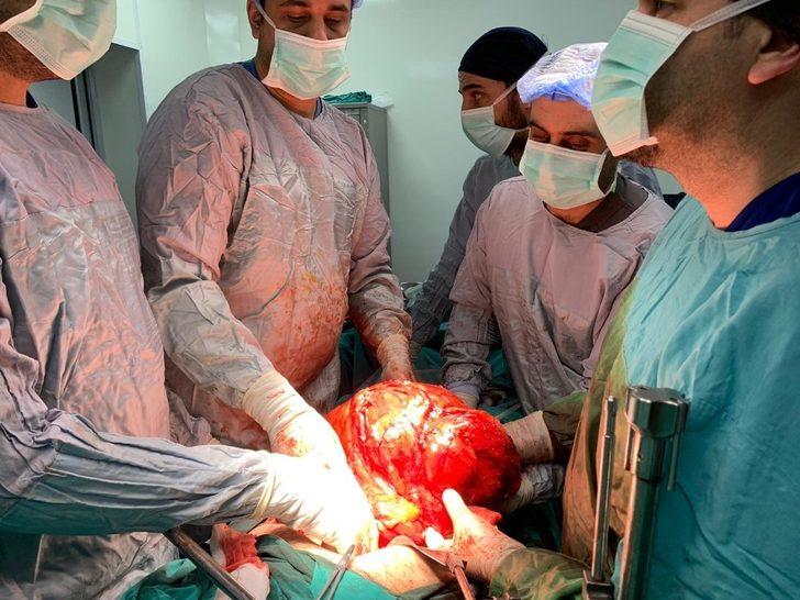 Şişlik nedeniyle gittiği hastanede karnında 11 kiloluk kitle olduğunu öğrendi G1