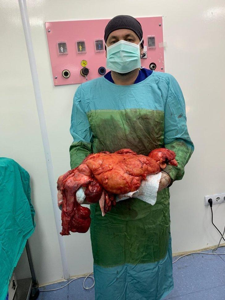 Şişlik nedeniyle gittiği hastanede karnında 11 kiloluk kitle olduğunu öğrendi G3