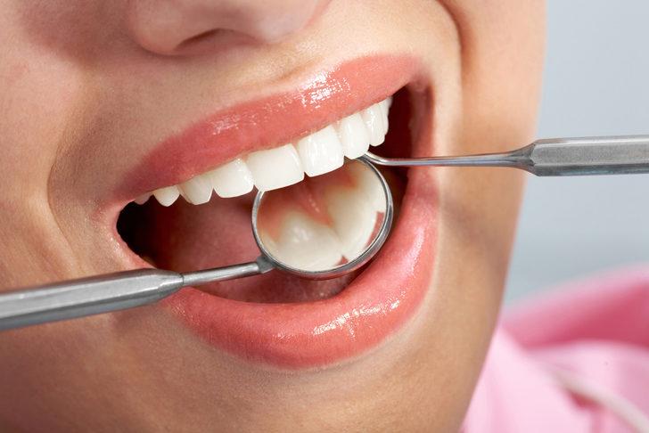 Dental lazer nedir? Diş eti ön planda olanlar dikkat! G2