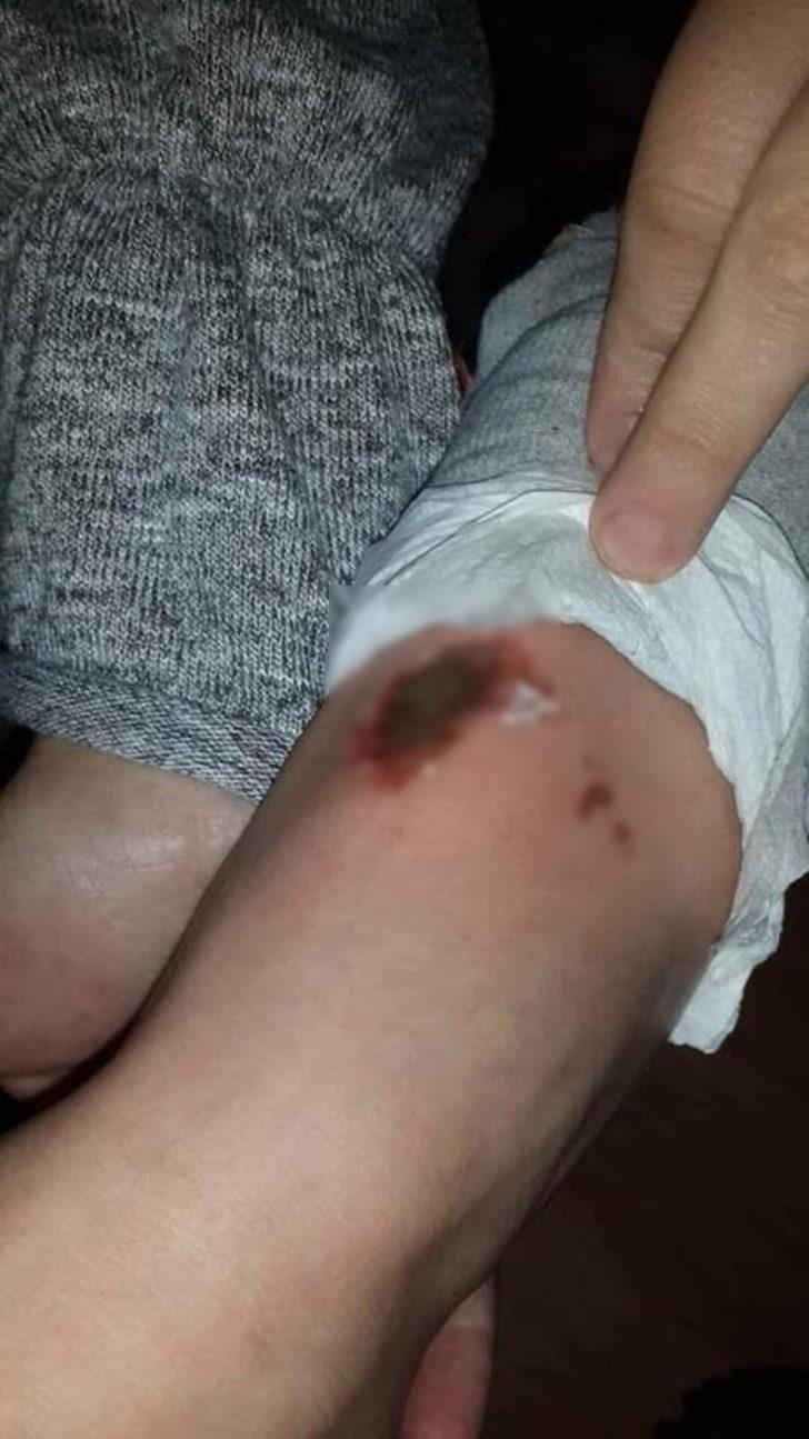 Kartopu oynarken vücudunda yaralar oluşmuştu! Akılalmaz iddia... G2