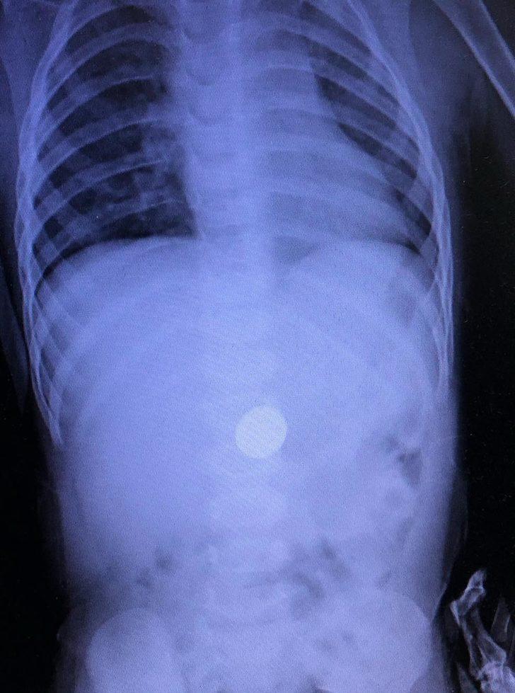 Aileler dikkat! Röntgende belli oldu G3