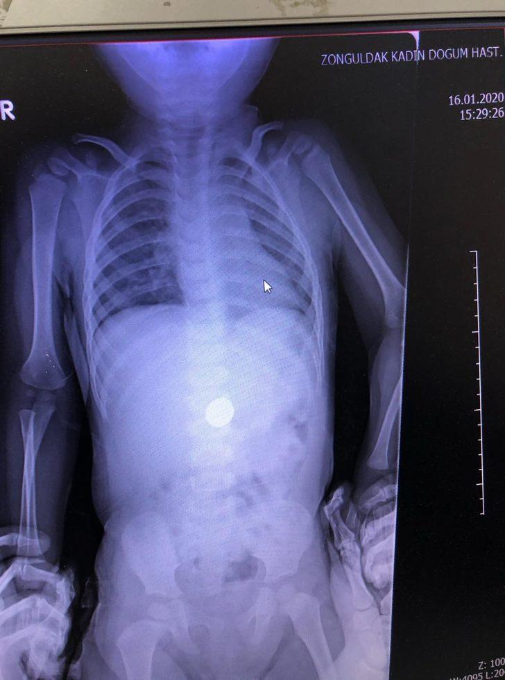 Aileler dikkat! Röntgende belli oldu G4