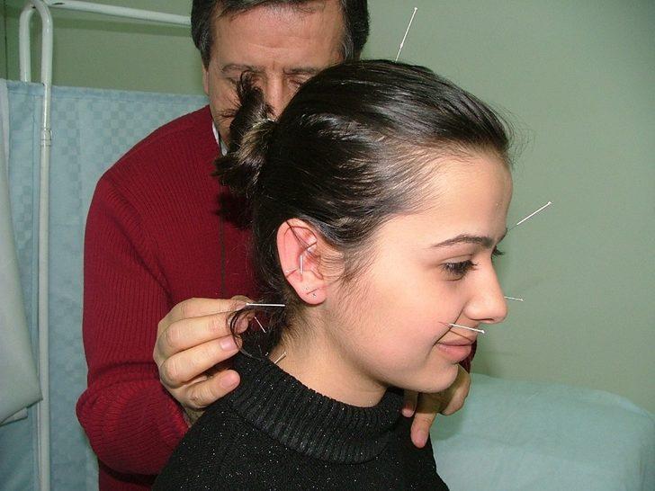 Akupunkturla şeker tedavisi mümkün mü? G2