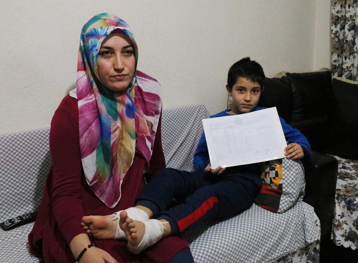 Kar topu oynarken vücudunda yanık oluşan 8 yaşındaki Mirzah taburcu oldu G1