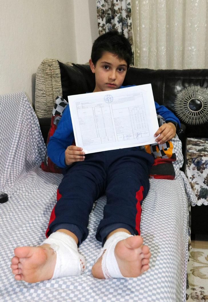 Kar topu oynarken vücudunda yanık oluşan 8 yaşındaki Mirzah taburcu oldu G4