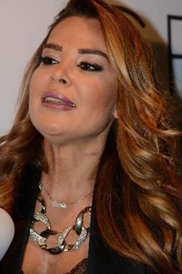 İçime attım böyle oldu G5