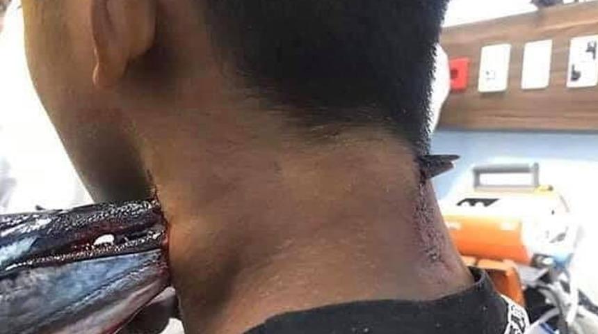 Denizden fırladı, ensesine saplandı!