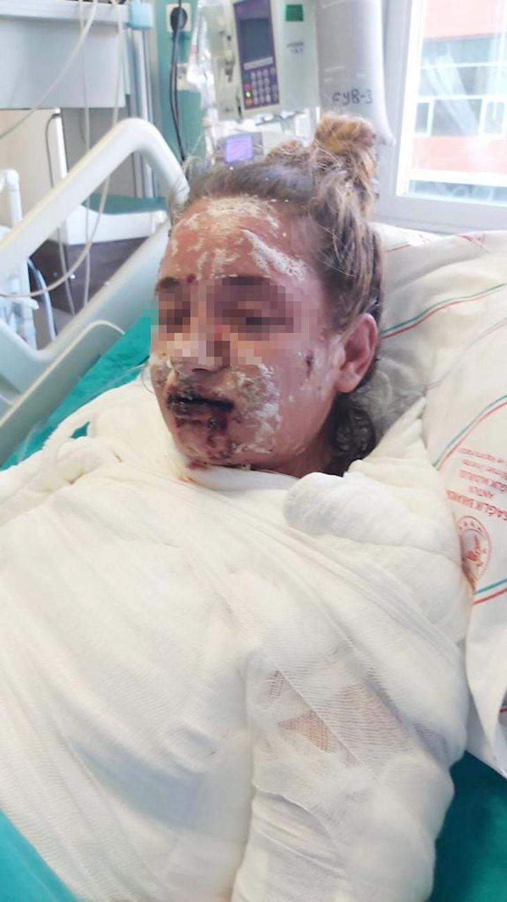 Aldığı ilaç liseli Mina'nın hayatını kabusa çevirdi! Vücudu yandı, görme yetisini kaybetti G3