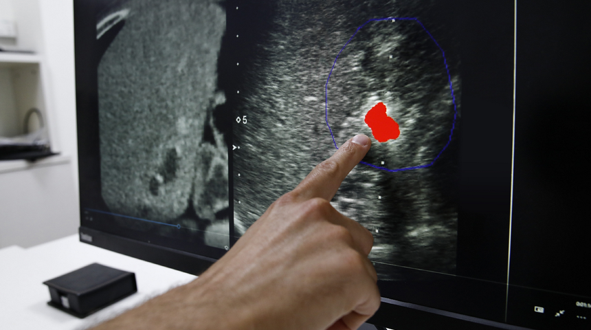  Kanser tedavisinde akıllı çözümler sunuyor