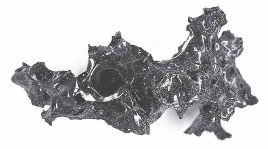 Beyni cama dönüşen adam şaşkınlık yarattı!