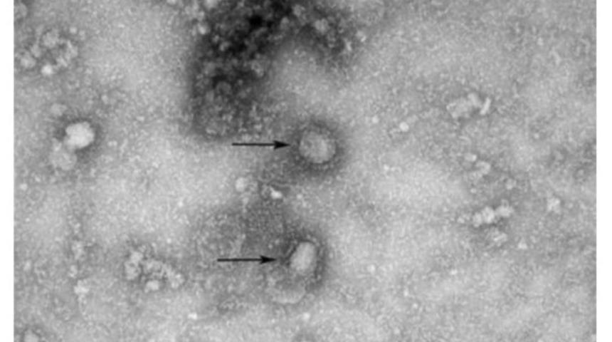 Koronovirüsün mikroskopla çekilen görüntüsü yayınlandı