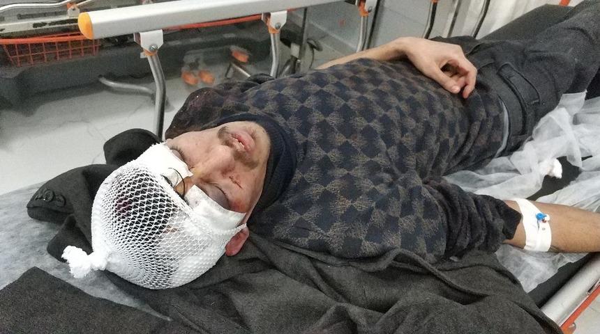 Samsun'da dehşet! Kapıyı kırıp, hastanelik ettiler