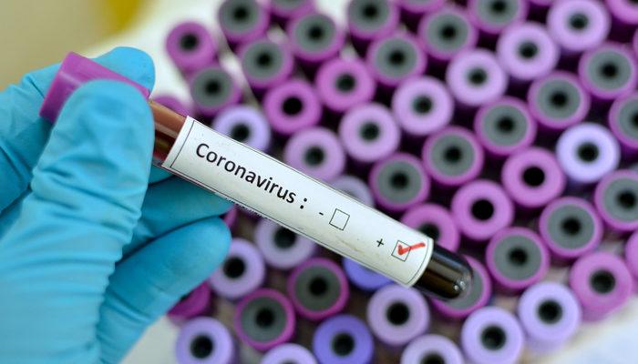 Coronavirus'den nasıl korunulur? Tehlike büyük ama önlemler basit!