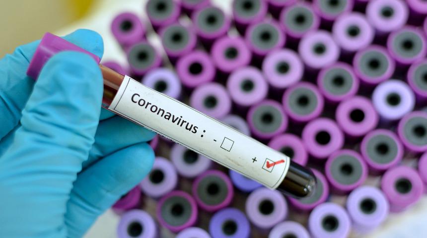 Coronavirus'den nasıl korunulur? Tehlike büyük ama önlemler basit! 