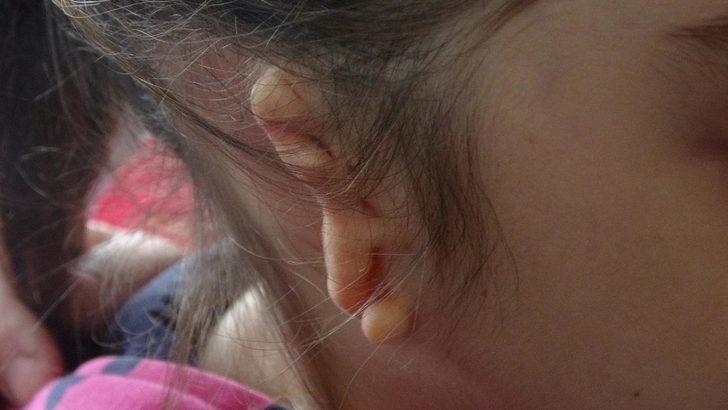 Haluk Levent'ten yardım istediler! İkbal'in kulaklarına kavuşması için 250 bin lira lazım G5