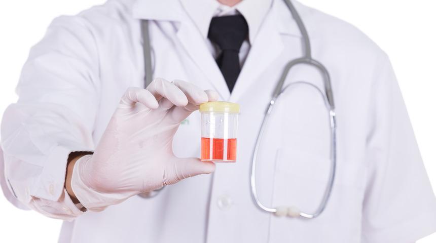 İdrar ile kan gelmesi ne anlama geliyor?