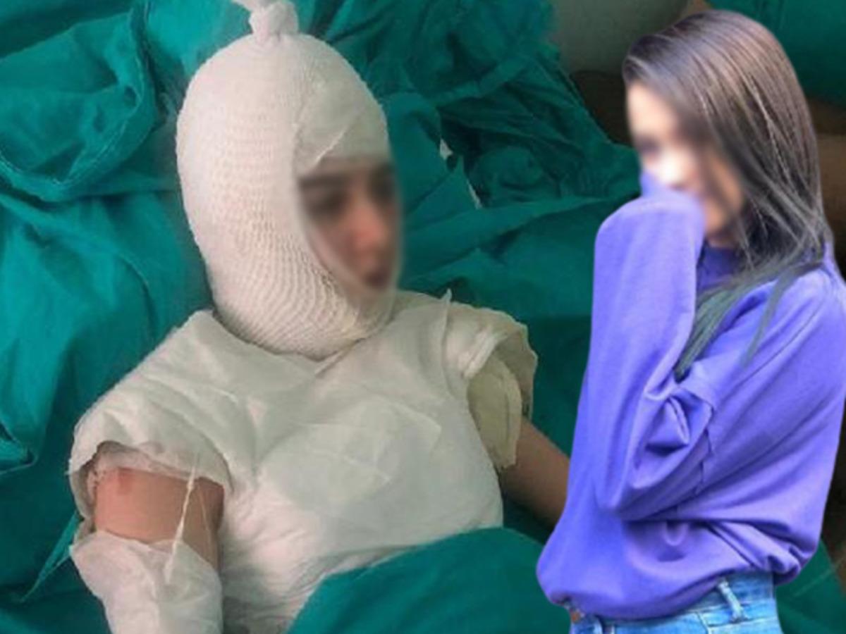 İstanbul'da &uuml;vey anne dehşeti! Kaynar suyu başından aşağı d&ouml;kt&uuml;