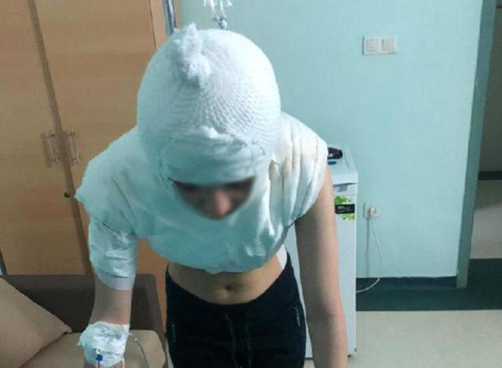 14 yaşındaki kızın başından aşağı kaynar su dökülmüştü! Mahkemeden flaş karar G1