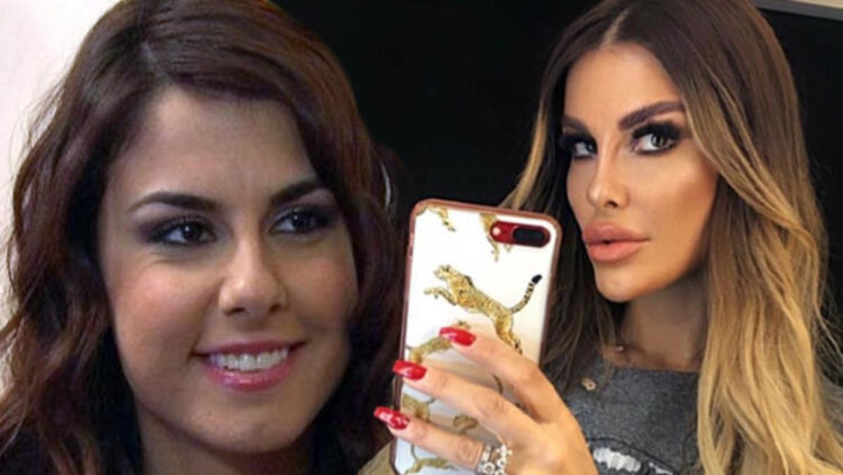 Tuğ&ccedil;e &Ouml;zbudak'tan estetik a&ccedil;ıklaması! 'Dudaklarım s&uuml;rekli g&ouml;z&uuml;me k&uuml;&ccedil;&uuml;k g&ouml;r&uuml;n&uuml;yor'