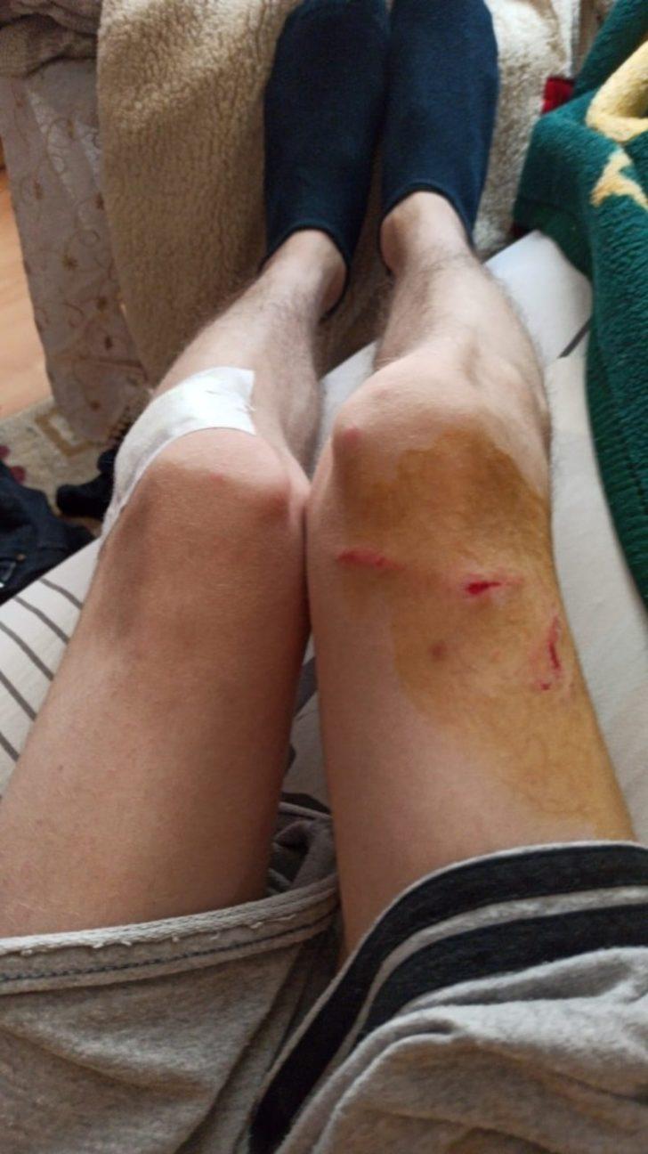 Kendisine saldıran köpekle boğuşan genç yaralandı G1