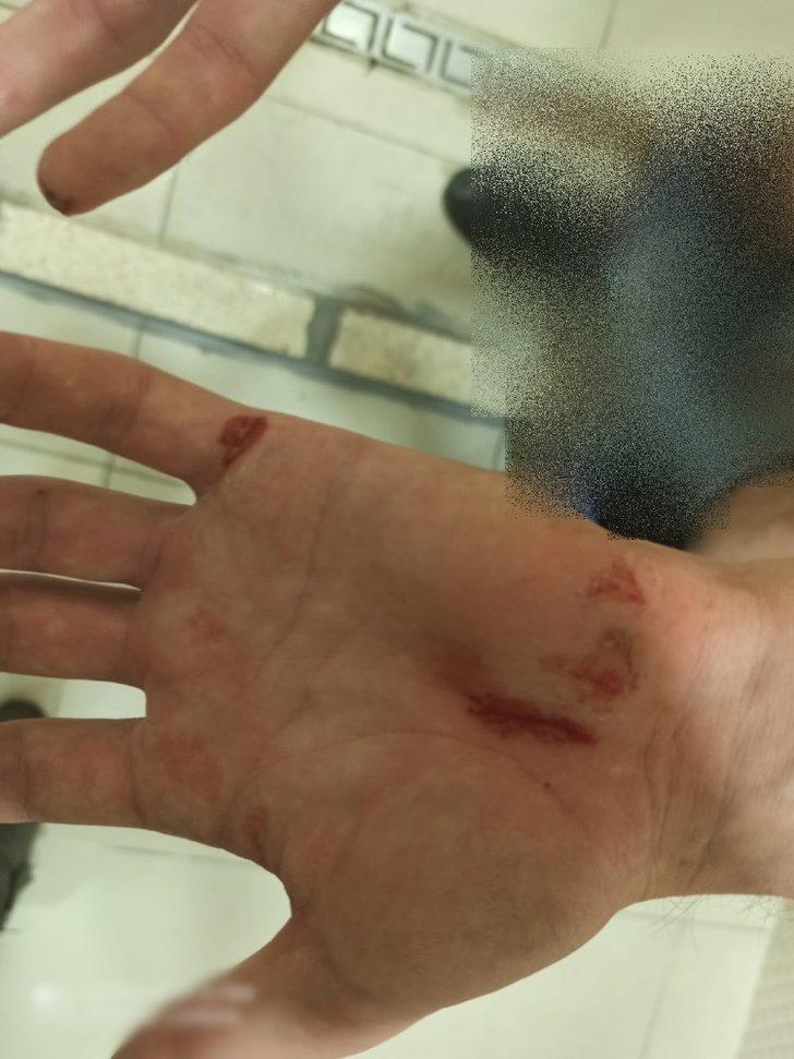 Kendisine saldıran köpekle boğuşan genç yaralandı G4