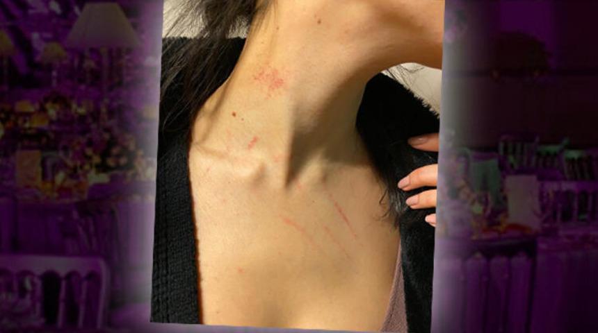 Beşiktaş'ta &ccedil;alışanına cinsel saldırı iddiasıyla g&ouml;zaltına alınan ş&uuml;pheli tutuklandı