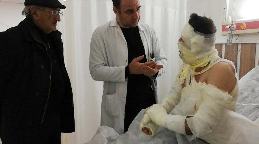 Erzincan &Ccedil;ayırlı'da sobaya benzin d&ouml;ken iki arkadaş kendilerini yaktı