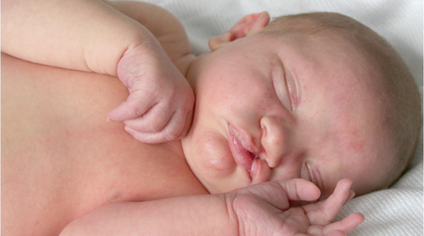 Dudak damak yarıklarında hangi ameliyatlar ne zaman yapılır?