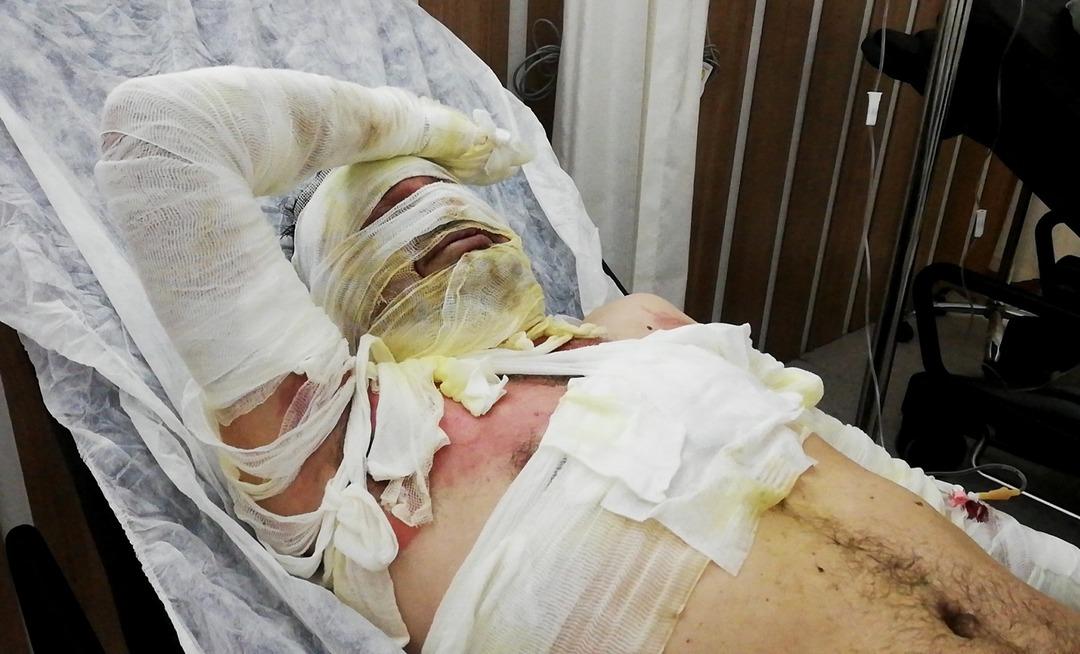 Korkun&ccedil; kaza! 'Soyunuyorum soyunuyorum bitmiyor'