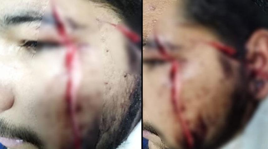 Fal&ccedil;atalı saldırganlar tutuklandı