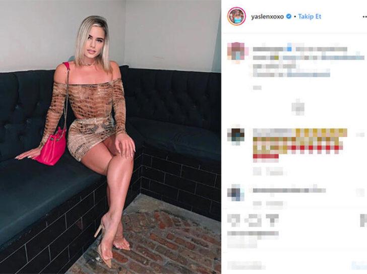 'Arkadaşlarım sürekli alay ediyordu!' Artık bambaşka biri oldu! G1