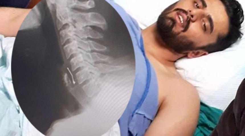 Yer: Kahramanmaraş! Doğum günü pastası yerken boğazına toplu iğne saplandı