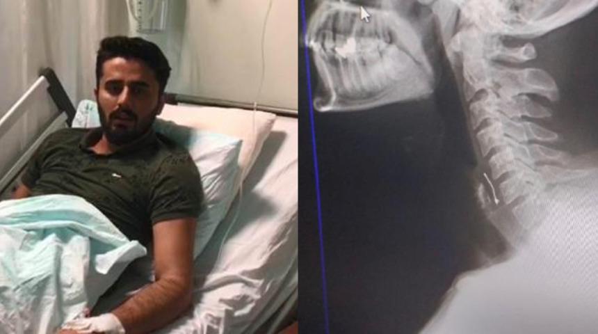 Pasta yerken ölüyordu! 'Çikolata zannedip yuttum'