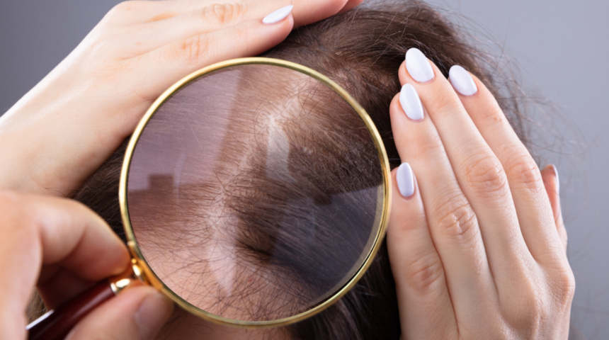 Mevsim saç ekiminde etkili midir?