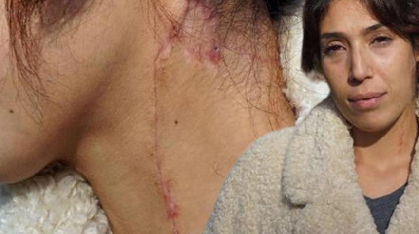 Aldattığı iddiasıyla boğazı kesilip, 5 yerinden bı&ccedil;aklamıştı! Oya  Aydoğdu dehşet anlarını anlattı