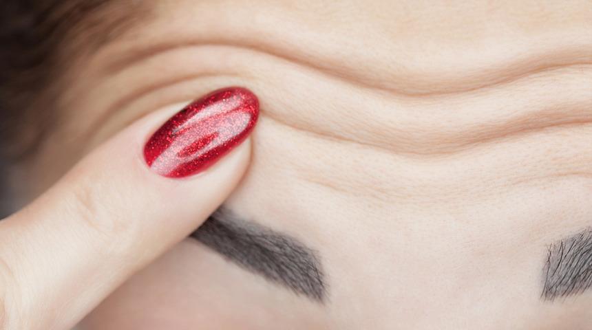 Önleyici botoks nedir?