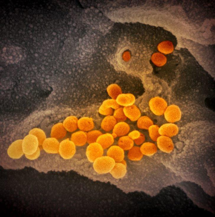 Koronavirüs fotoğrafları yayımlandı! G4