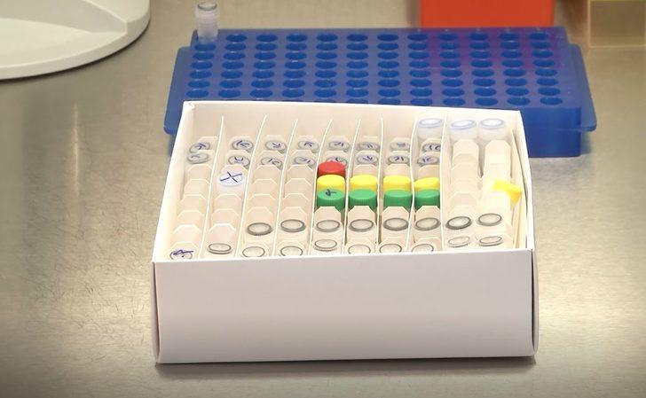 Koronavirüsü teşhisi bu kit ile 15 dakikada gerçekleşecek G4