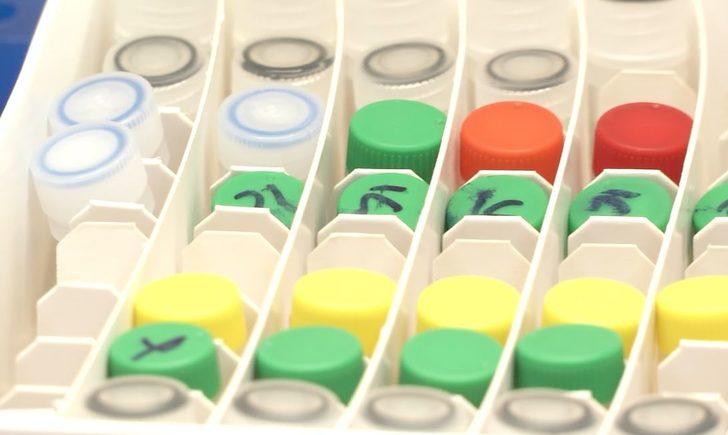 Koronavirüsü teşhisi bu kit ile 15 dakikada gerçekleşecek G3