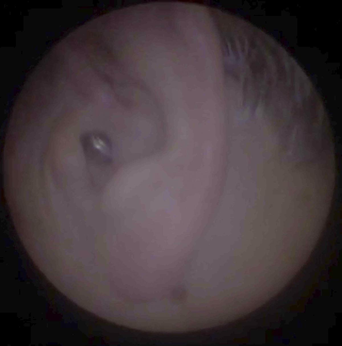 Hastanın kulağından pil &ccedil;ıktı