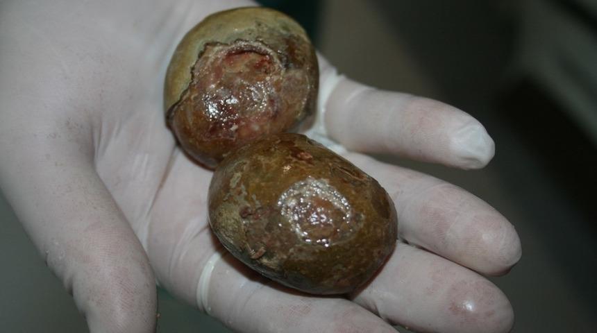 Mesanesinden çıktı! Büyüklüğünü görünce şaşkına döndü