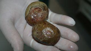 Mesanesinden çıktı! Büyüklüğünü görünce şaşkına döndü