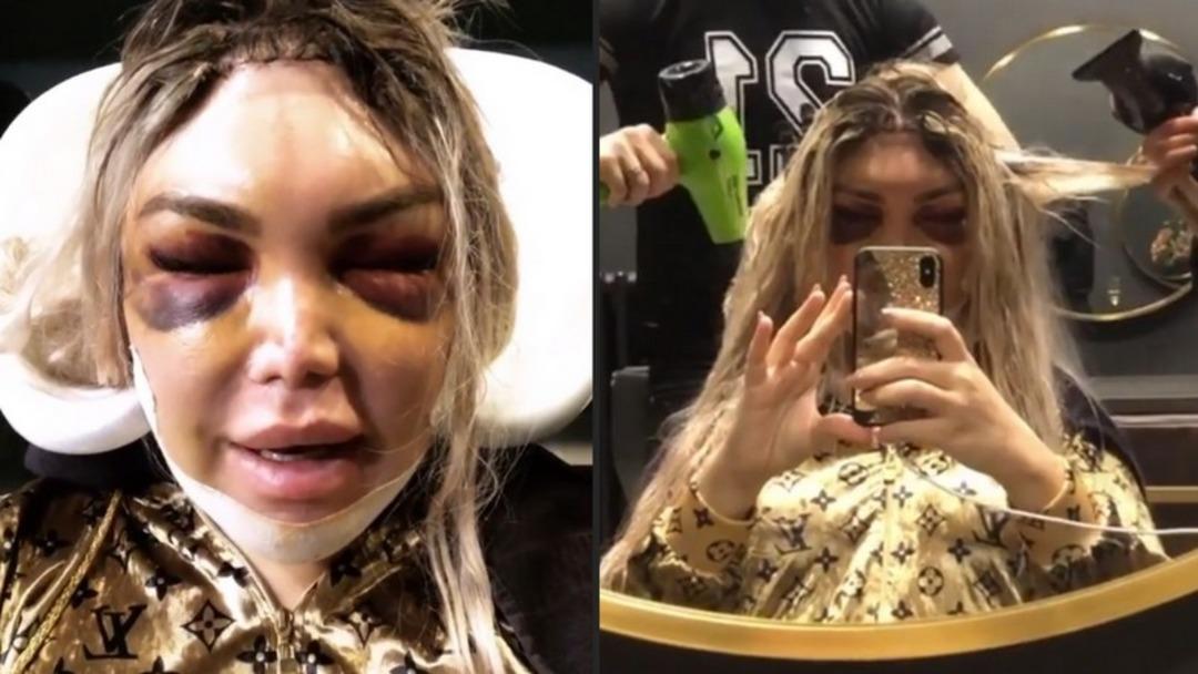 Rodrigo Alves'ten estetik operasyon sonrası kuaf&ouml;r ziyareti