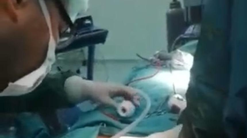 Nevşehir&rsquo;de ilk kez ağız i&ccedil;inden guatr ameliyatı yapıldı