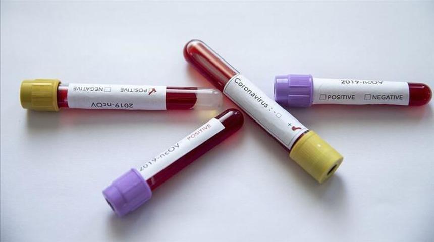 İran'da ölümlerin ardından 3 kişide daha koronavirüs tespit edildi