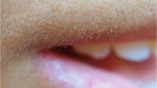 Kadınlarda aşırı tüylenme neden olur? İşte altında yatabilecek sebepler