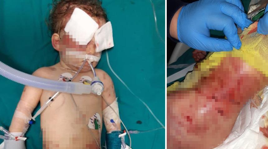 Dehşet anlarını anlattı: K&ouml;pek &ccedil;ocuğumun kafasını ağzına aldı